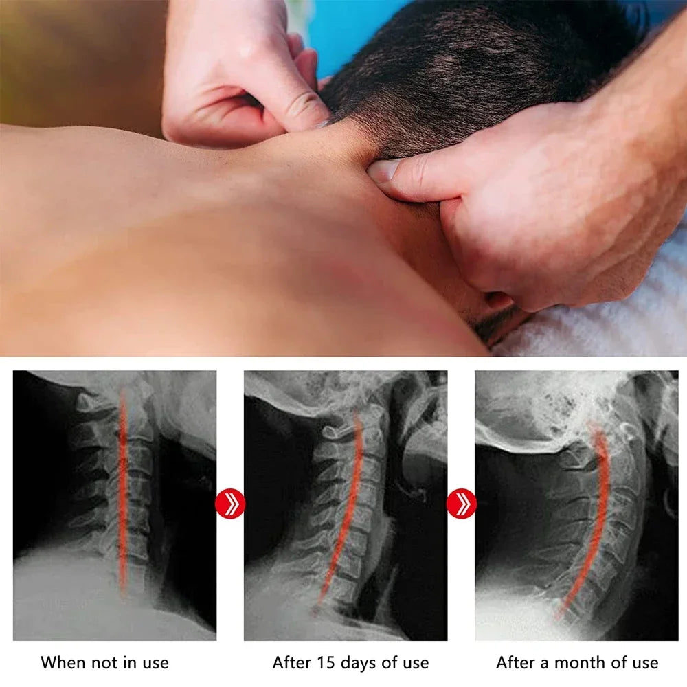 Acupression cervicales discale lombaire